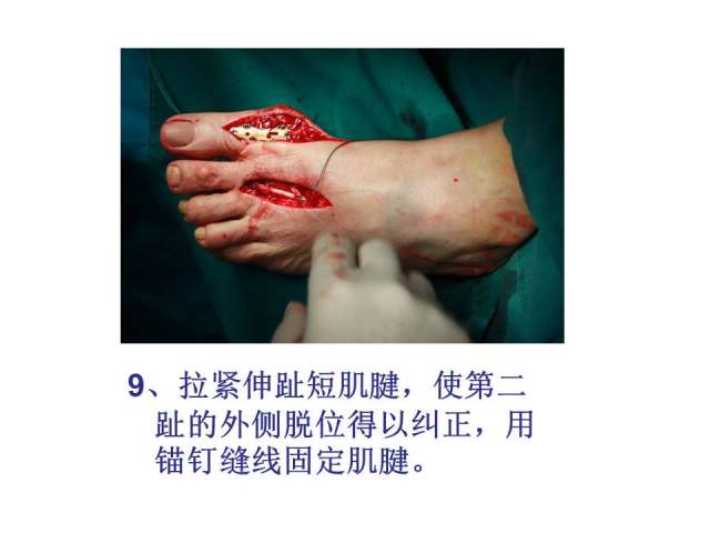 幻灯片20.JPG