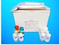 Growth Factor Receptor Bound Protein 7 ELISA Kit (Grb7), Human