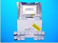 Islet cell antibody ELISA Kit (ICA), Human