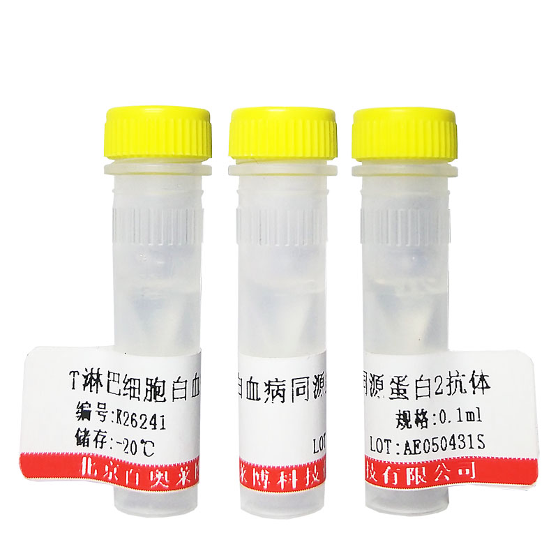 北京现货K24098型磷酸化核转录因子NFKB-RelB蛋白抗体优惠