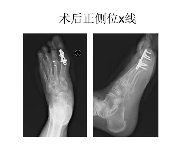 幻灯片21.JPG