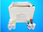 Hexokinase ELISA Kit (HK), Human
