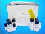 Islet antigen-2 antibody/protein-tyrosine phosphatase ELISA Kit (IA-2A/PTP), Human