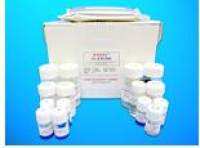 Nuclear factor NF-kappa-B p105 subunit ELISA Kit (NFKB1/p105), Human