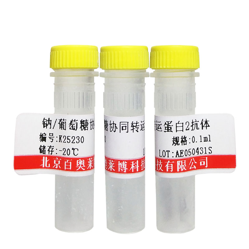北京现货HIV2 gp41 + gp160抗体库存