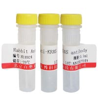 15 Lipoxygenase 2抗体厂家现货