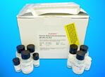 NADPH-cytochrome P450 reductase (POR) ELISA Kit, Human