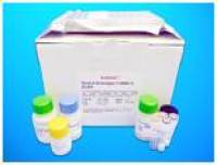 Muscle, skeletal, receptor tyrosine kinase ELISA Kit (MuSK), Human