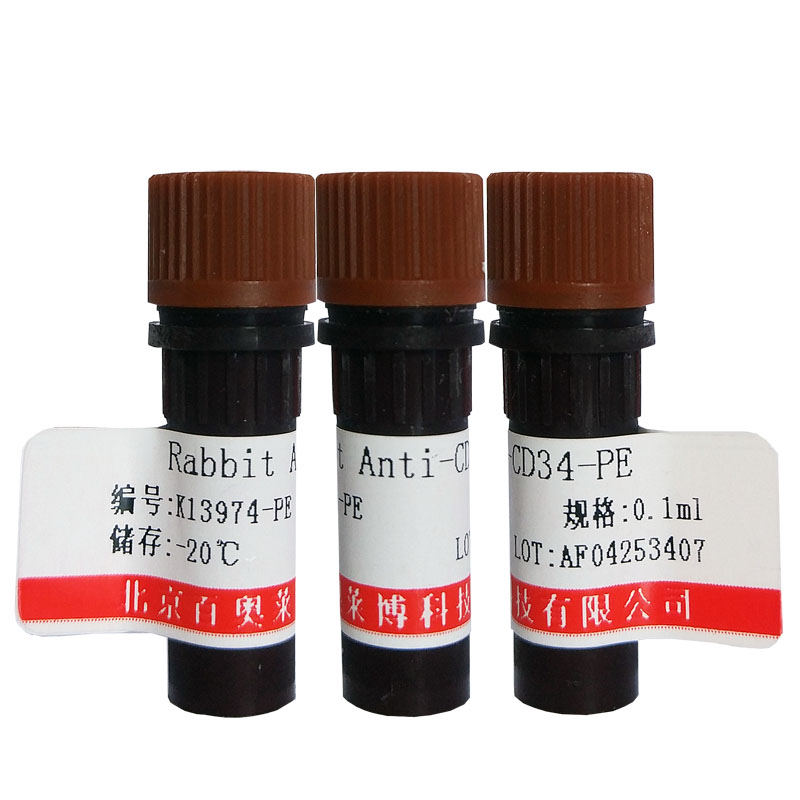 北京磷酸化PRKCA(Thr637)抗体厂商