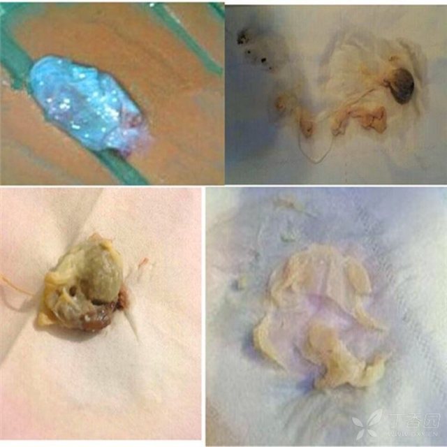 丁香园论坛 - 专业医生社区,医学,药学,生命科学,科研学术交流