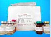 Myosin Heavy Chain 6 Cardiac Muscle Alpha ELISA Kit (MYH6), Human