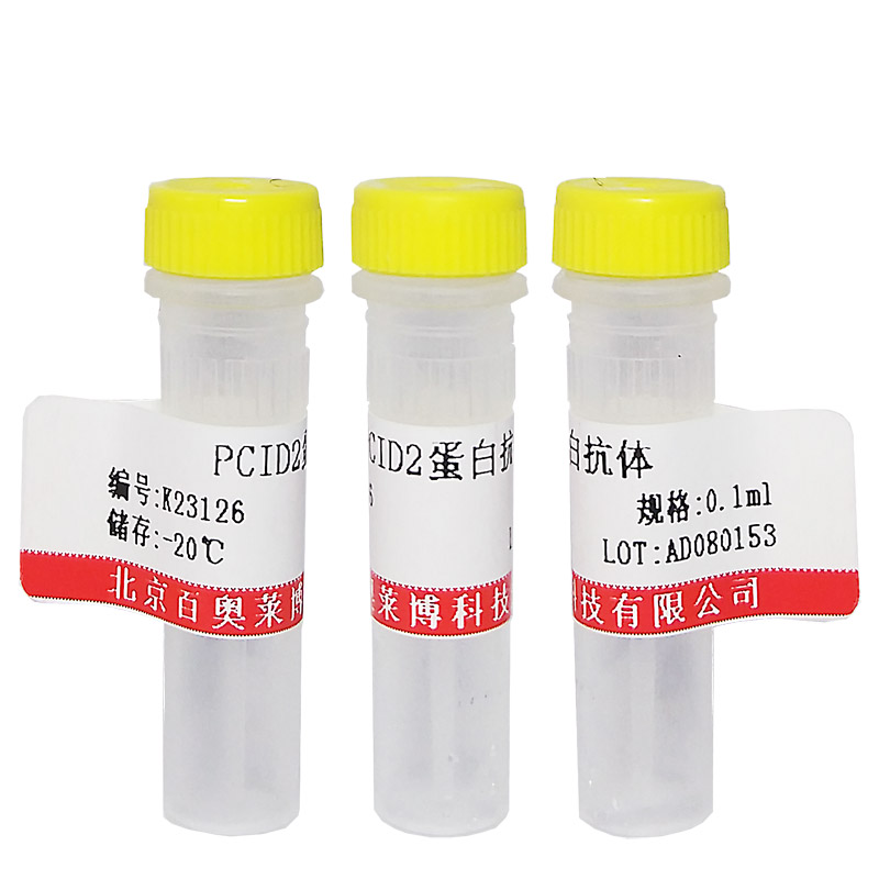 北京磷酸化SPHK2 (Thr614)抗体说明书