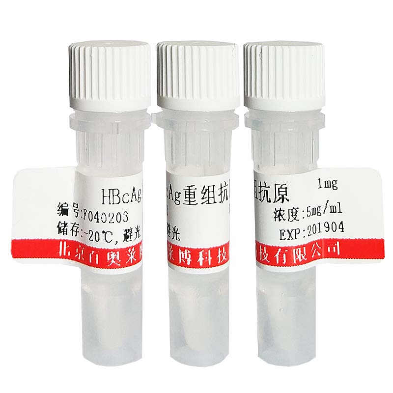 北京现货K20637型MPP4抗体优惠