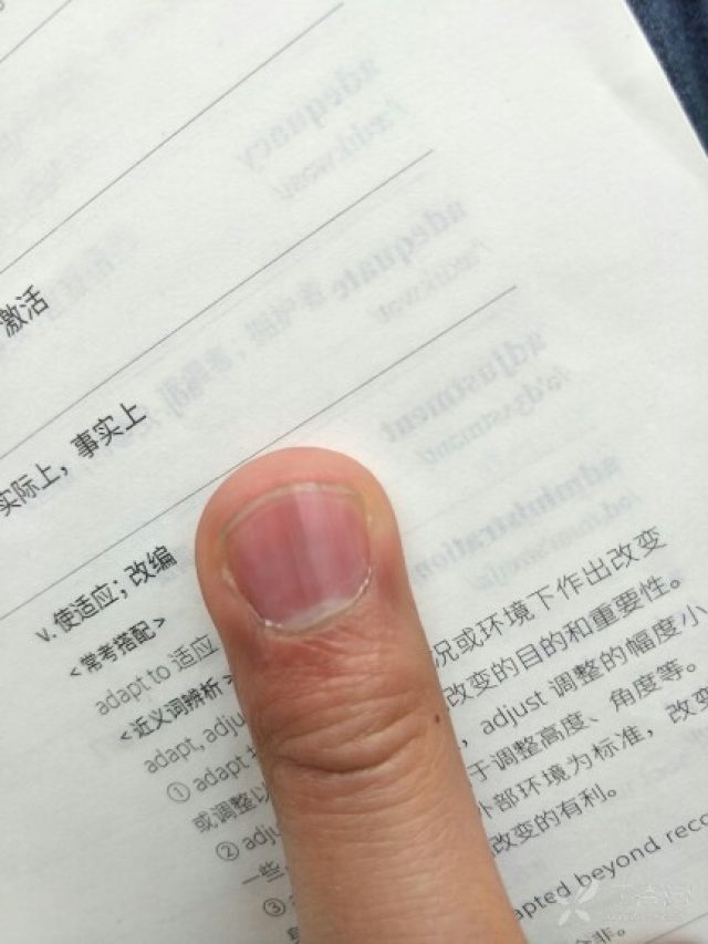中指指甲间有一条棕色的竖线条,是怎么回事呢?求各位大神们解.