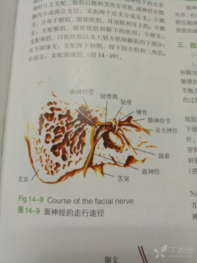 第二:乳突 很重要的解剖结构,其根部的前内方有茎乳孔,面神经由此出颅