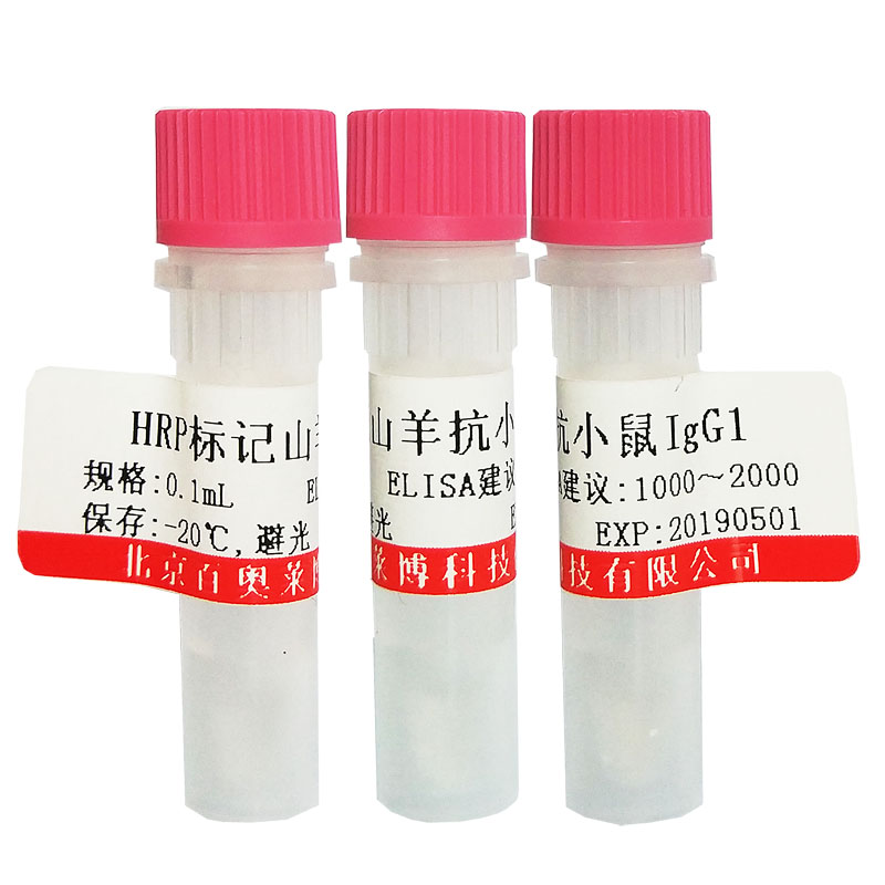K15178型磷酸化EphB1 (Tyr928)抗体北京现货促销