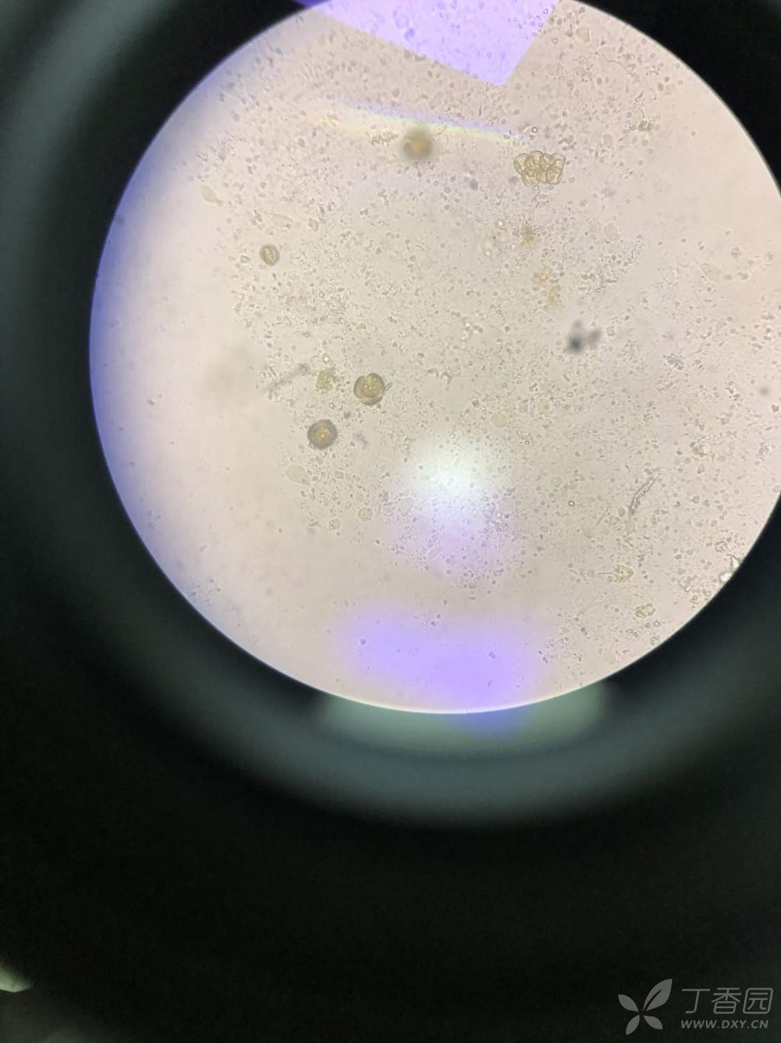 大便里霉菌镜鉴图片图片