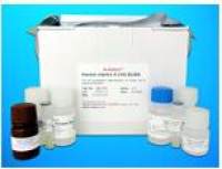 Serine/threonine protein kinase ELISA Kit (STK), Human