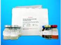 Platelet Derived Growth Factor Subunit A ELISA Kit (PDGFA), Human