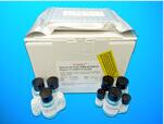 Proline ELISA Kit, Human