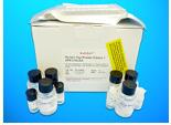 Receptor Activator of Nuclear Factor Kb Ligand ELISA Kit, Human