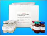 Anti-Growth Hormone Antibody (Anti-GHAb) ELISA Kit, Human