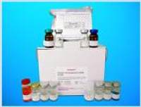 Thromboxane synthase ELISA Kit (TXS), Human