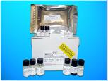 Thyroid antibody ELISA Kit (TAB), Human
