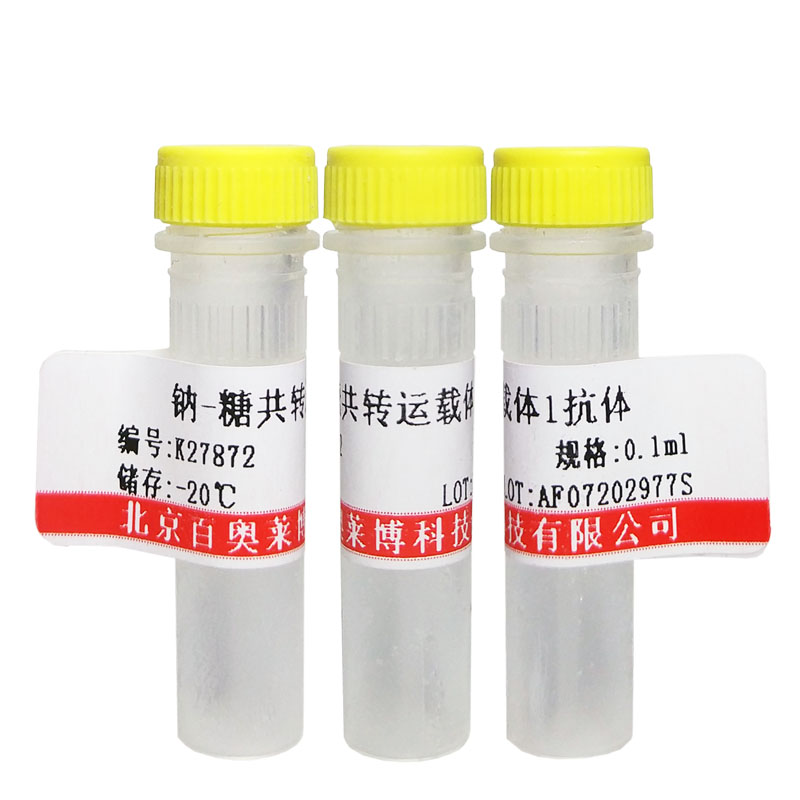 北京HP1BP3抗体价格