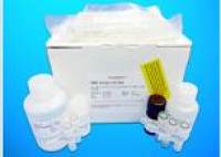 Transglutaminase ELISA Kit, Human