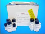 Actin Alpha 1, Skeletal Muscle ELISA Kit (ACTa1), Human