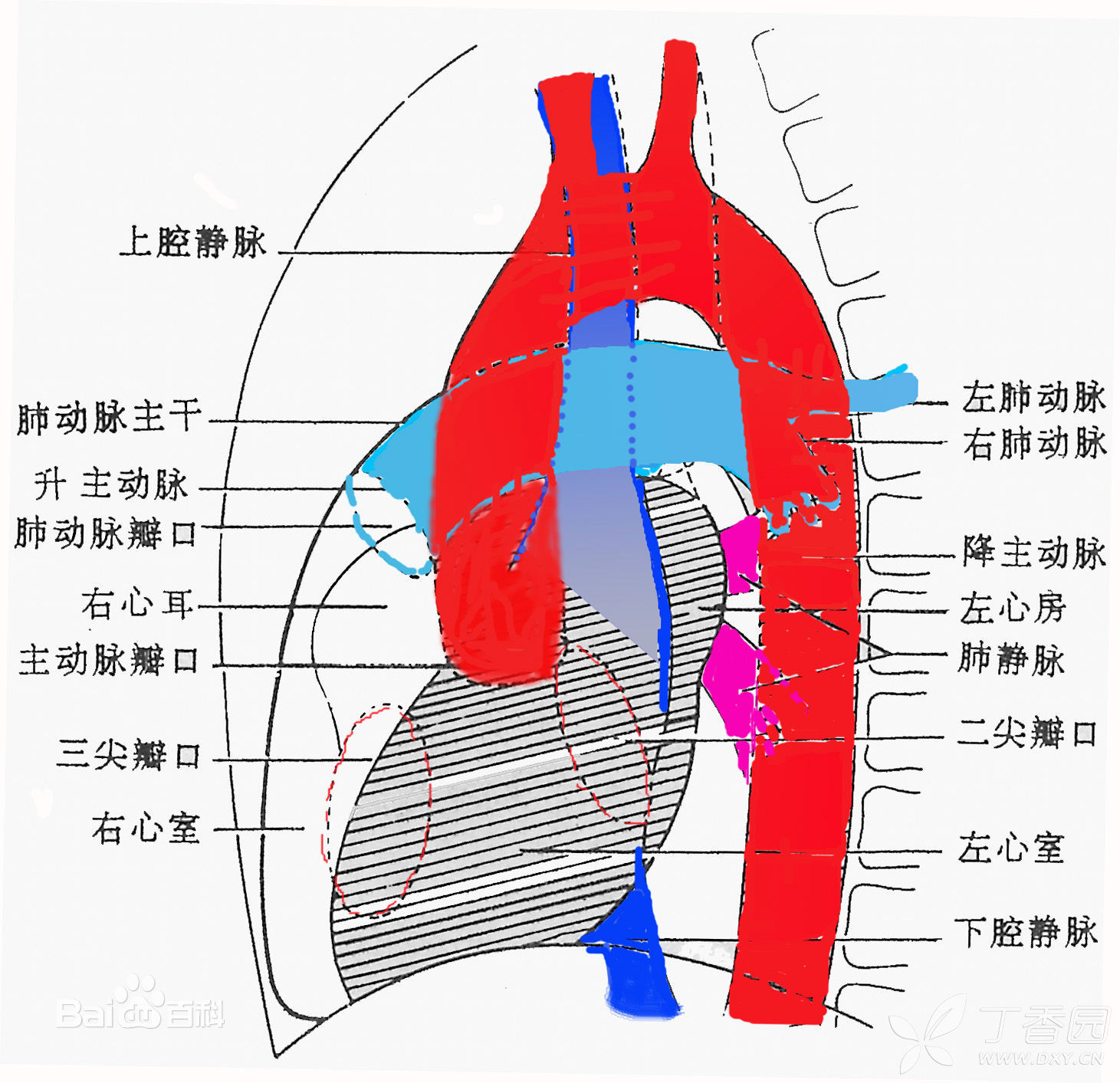 很容易看出来,如果把降主动脉夹闭,心脏破裂口的出血不可想象,更不要