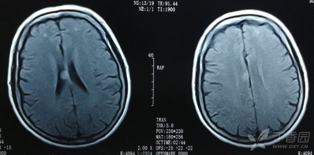 3278067568913127323-16w.jpg!w640