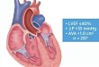 TAVR 治疗低射血分数、低跨瓣压差重度主动脉瓣狭窄患者