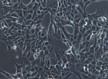 小鼠乳腺癌细胞4T1