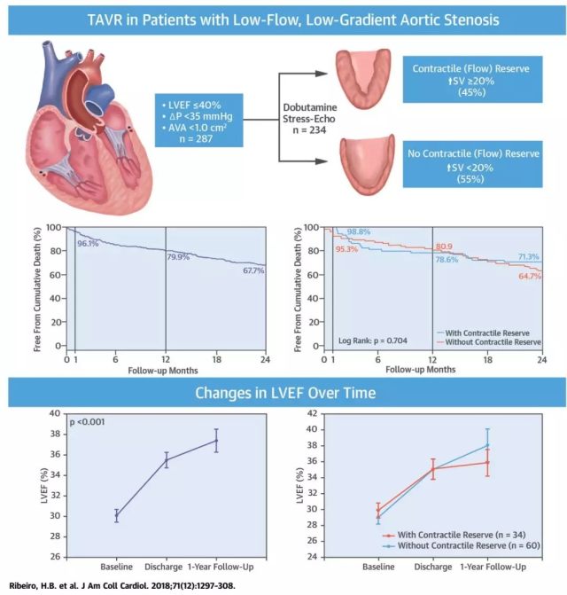 血瓣花苗 TAVR 治疗低射血分数、低跨瓣压差重度主动脉瓣狭窄患者