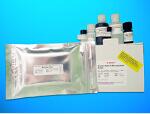 Alpha-N-acetylgalactosaminide alpha-2, 6-sialyltransferase 6 (ST6GALNAC6) ELISA Kit, Human产品图