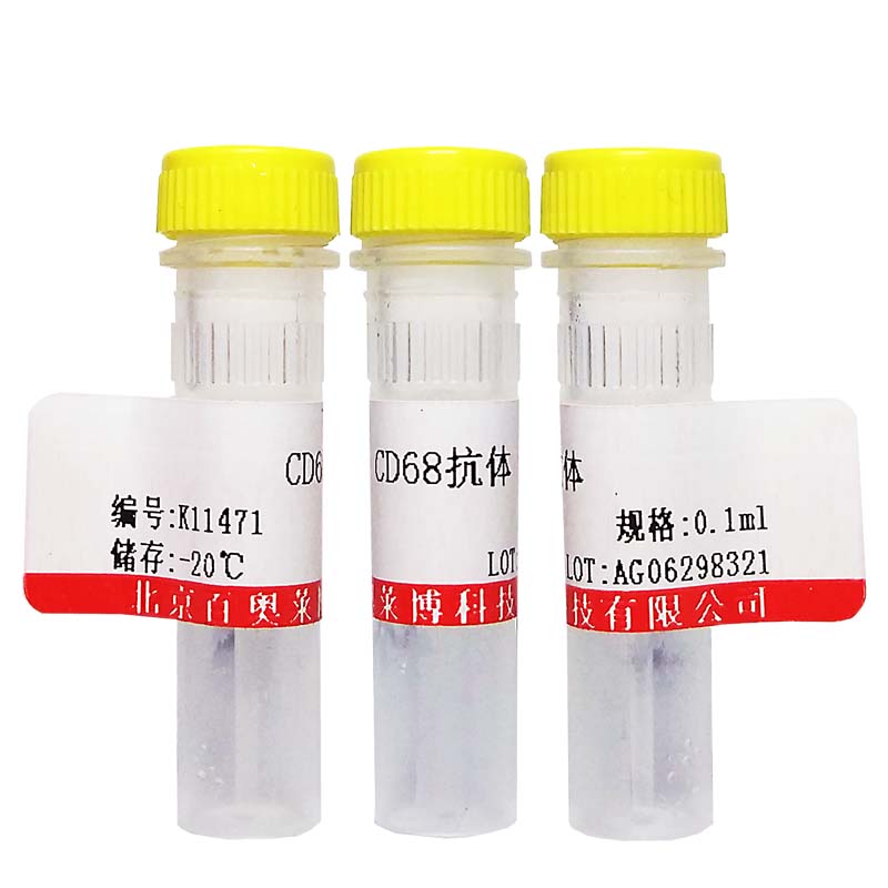 北京磷酸化DDX58 (Ser8)抗体厂家价格