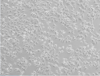 5637人膀胱癌细胞