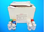 Apolipoprotein C4 ELISA Kit (APOC4), Human