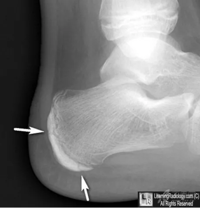 丁香园论坛 - 专业医生社区,医学,药学,生命科学,科研学术交流