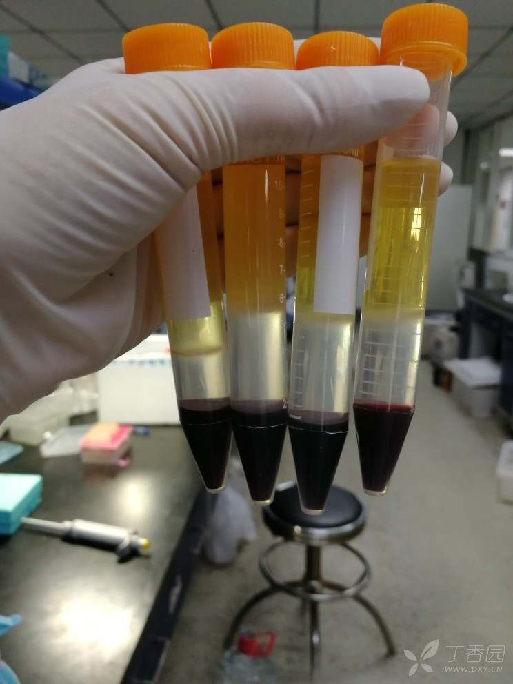 外周血单个核细胞