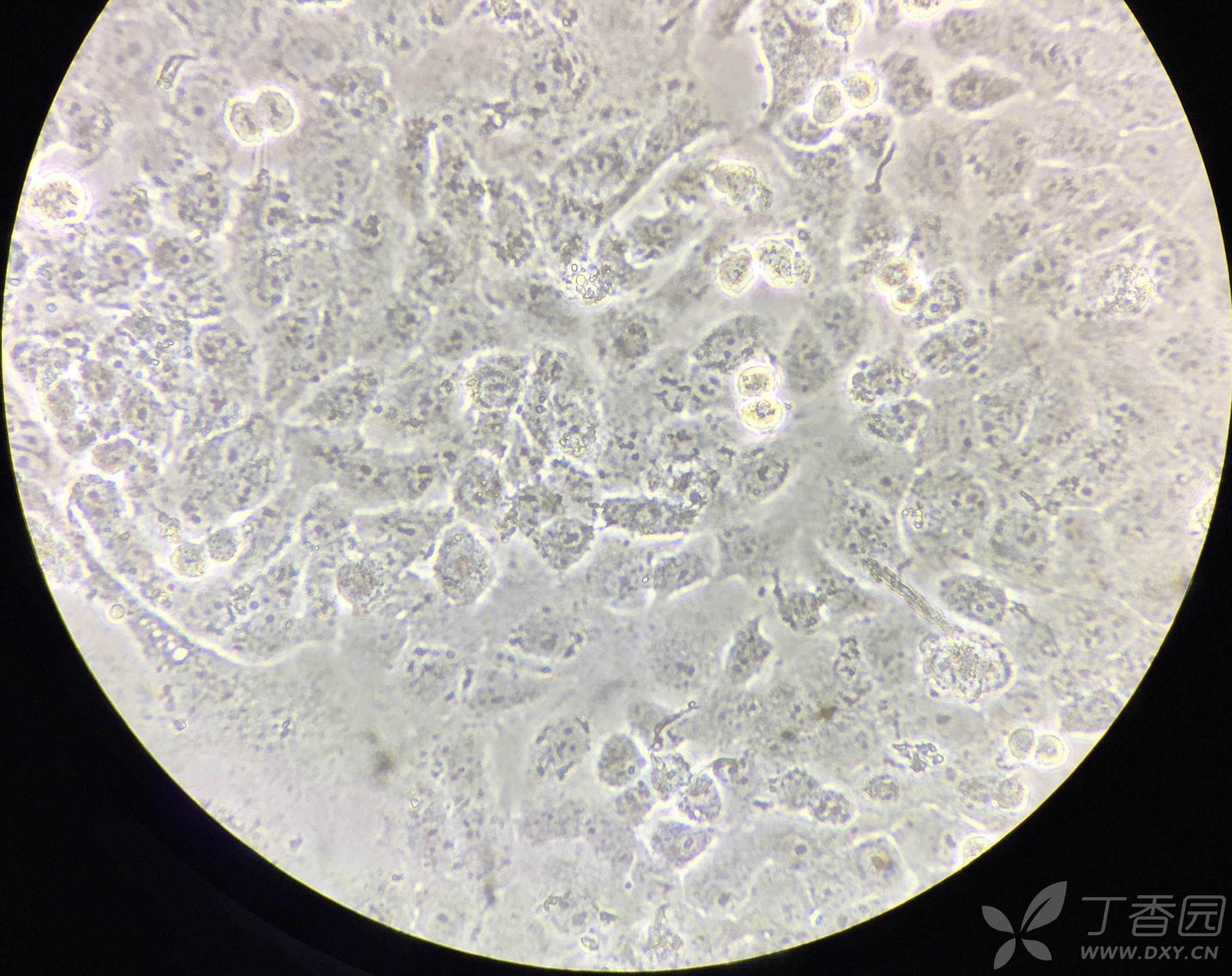谁有标准的cal-27舌鳞癌细胞图片,求大神给看一眼长什么样子,最近在养