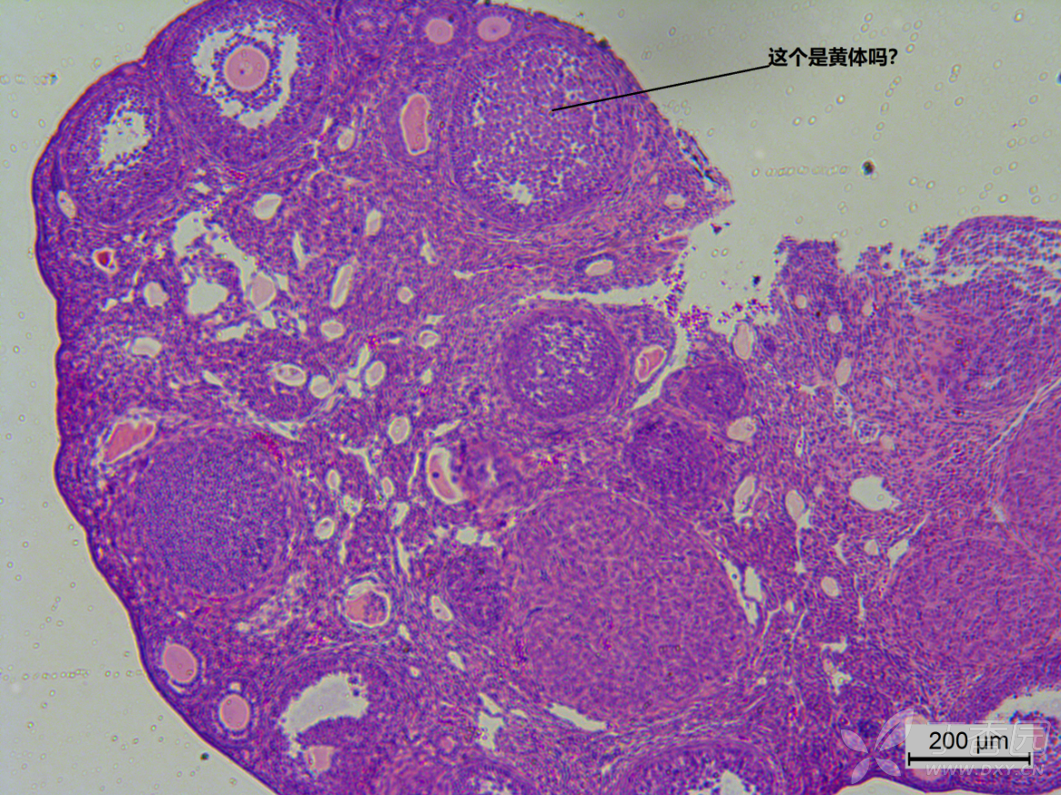 求帮忙辨认小鼠卵巢的黄体