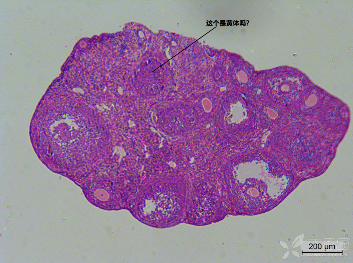 求帮忙辨认小鼠卵巢的黄体