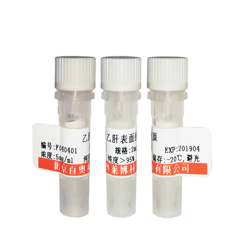 磷酸化EDG1 (Thr236)抗体优惠促销