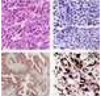 RAR相关孤儿素受体γ(RORg)免疫组化试剂盒人样本检测