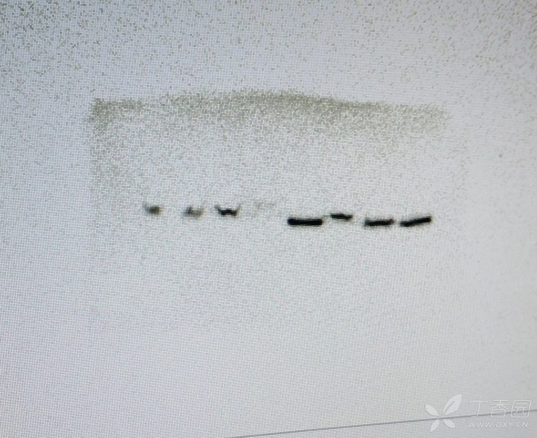 western blot