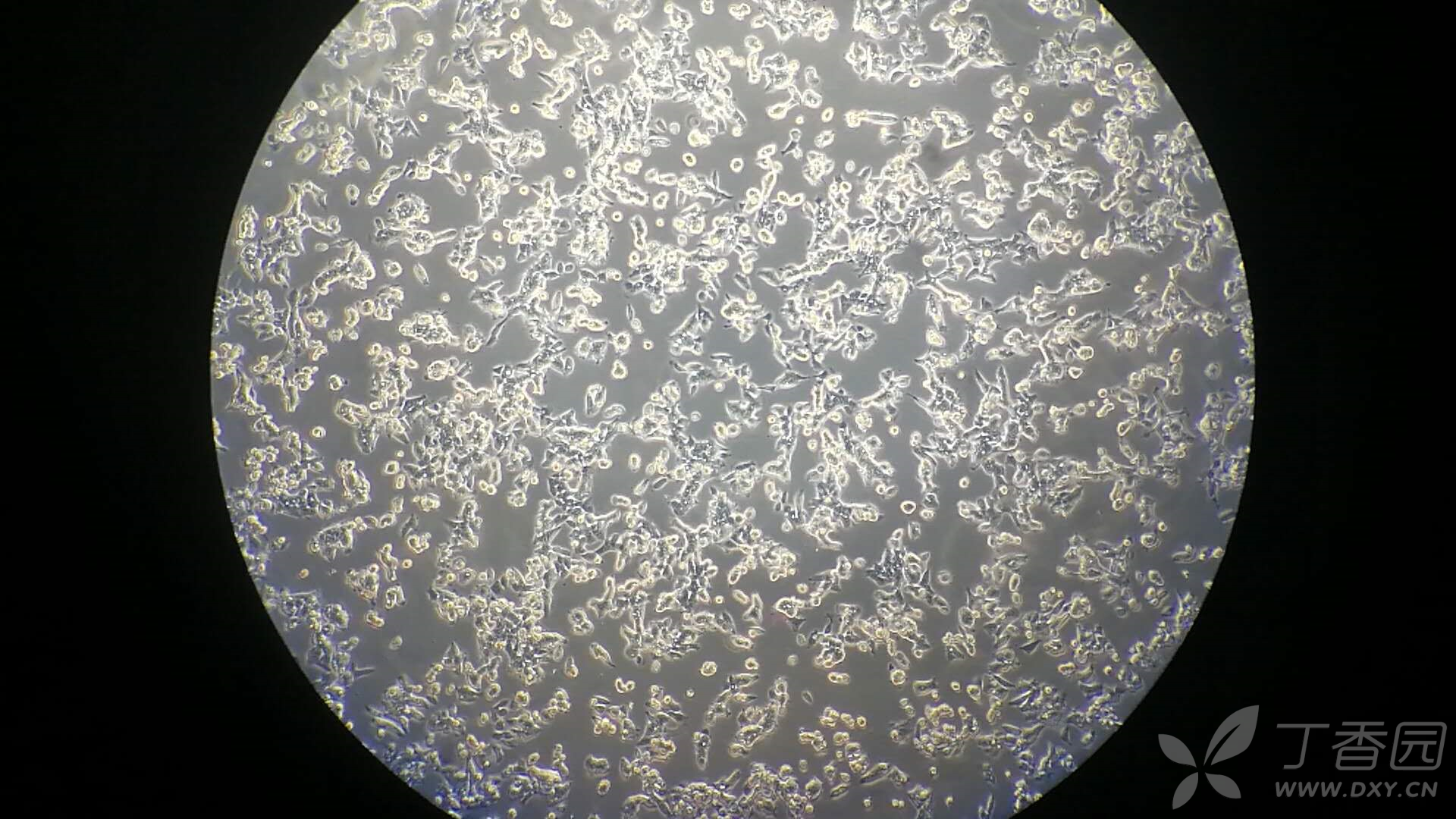 lovo细胞两天不换液就漂