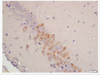 Tyrosine Hydroxylase antibody